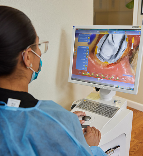 What Are CEREC Dental Crowns in Santa Maria from Santa Barbara Family Dentistry Image.