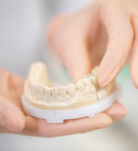 Dental Implants in Santa Maria Image.