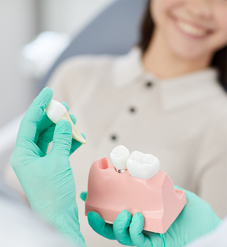 Why Do I Need Dental Extractions in Santa Barbra Family Dentistry Santa Maria CA Image.