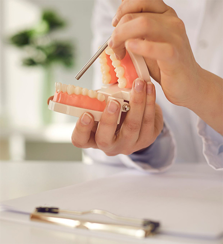 What Are Implant-Supported Dentures in Santa Maria Image.