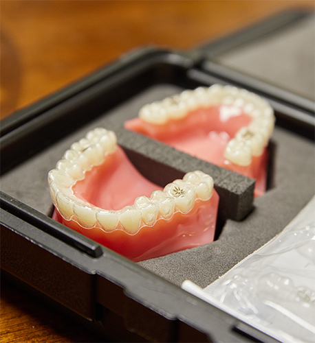 What Are Invisalign® Clear Aligners in Santa Maria Image.
