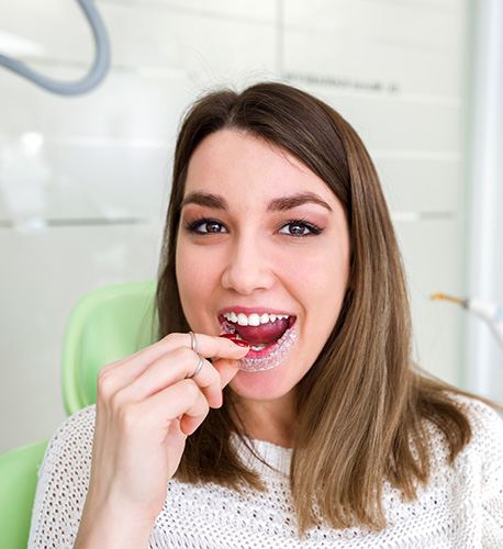 How Often Do I Need to Wear My Clear Aligners in Santa Maria Image.