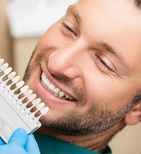What Are Composite Veneers from a Santa Maria Cosmetic Dentist in Santa Maria Image.