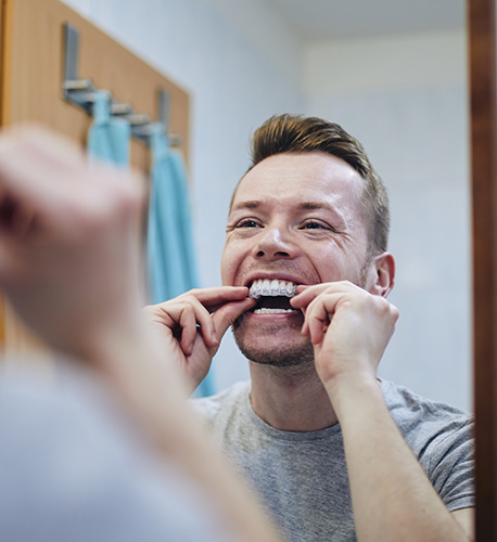 What Is At-Home Teeth Whitening in Santa Maria Image.